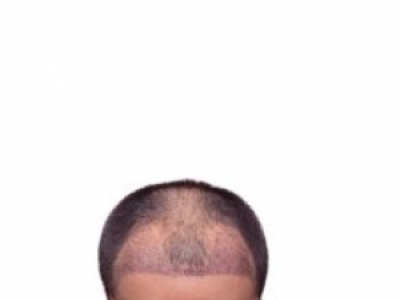 o(w)ֲl(f)挍(sh)Чc(g)˲Ӱ푽x