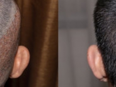 ͺֲl(f)g(sh)ҪX ͺֲl(f)rԔ